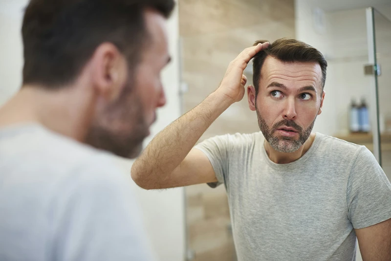 Mature man is worried about hair loss